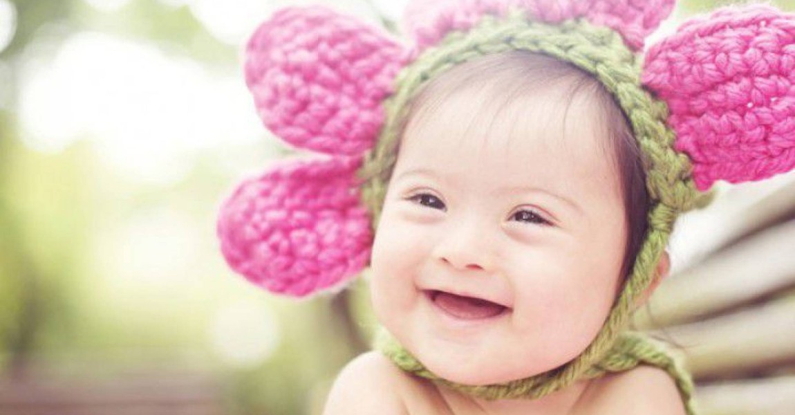 Dia Internacional da Sí­ndrome de Down: A importância de conscientizar