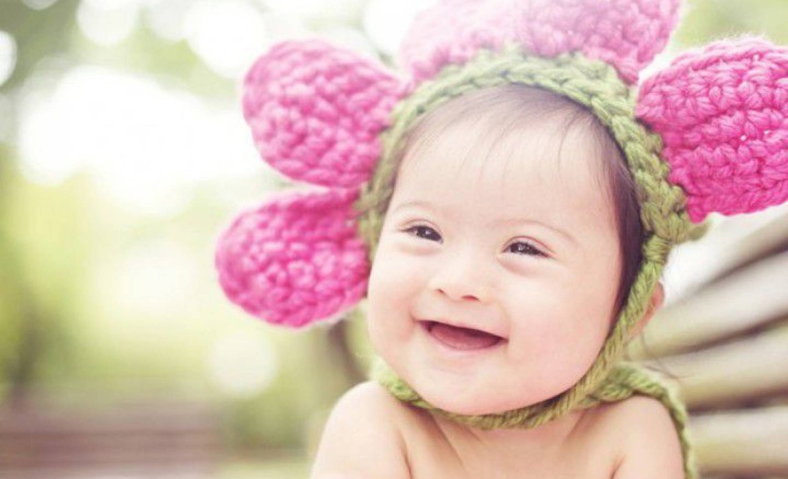 Dia Internacional da Sí­ndrome de Down: A importância de conscientizar